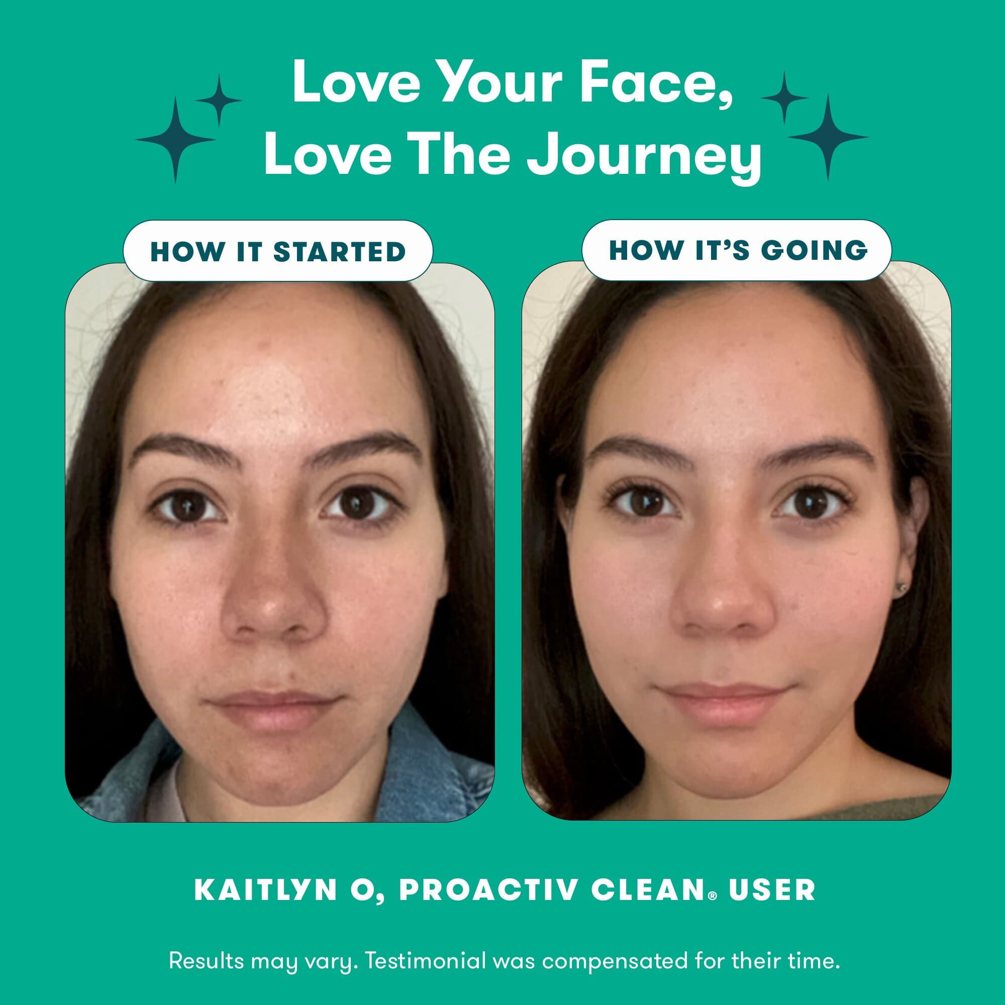 Proactiv Clean™ 3-Step Routine Kit with Zits Happen™ Patches, , large