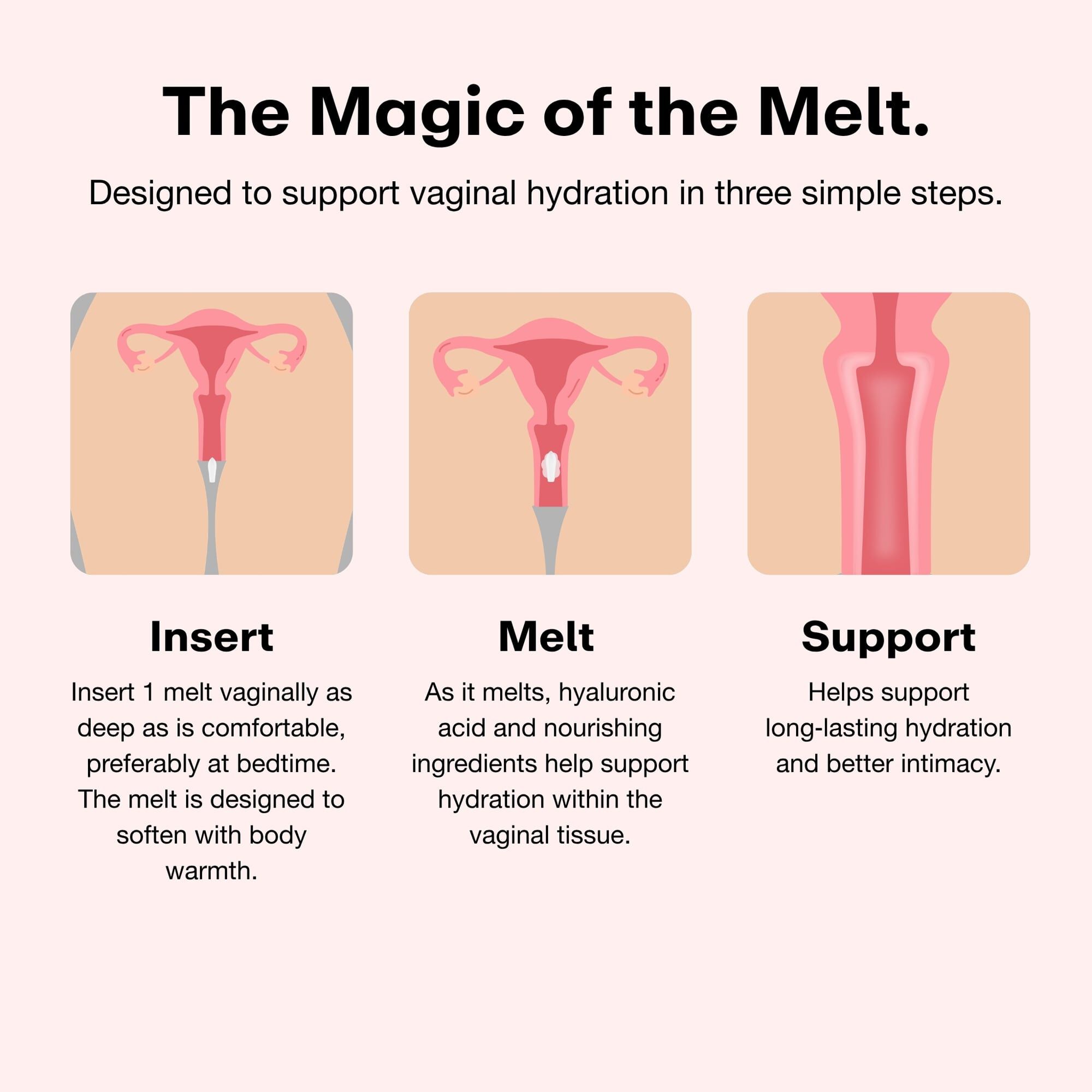 Joylux reliefHER™ Vaginal Hydration Melts, 5 ct., , large