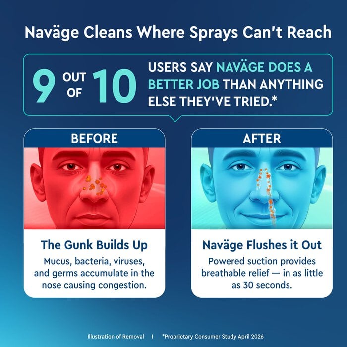 Navage® Advanced Powered Nose Cleaner, , large